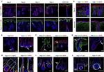 Rabbit IgG (H+L) Cross-Adsorbed Secondary Antibody in Immunohistochemistry (IHC)