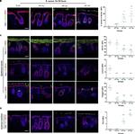 Rabbit IgG (H+L) Cross-Adsorbed Secondary Antibody in Immunohistochemistry (IHC)