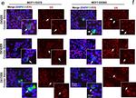 Rabbit IgG (H+L) Cross-Adsorbed Secondary Antibody in Immunocytochemistry (ICC/IF)