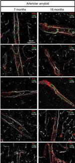 Mouse IgG (H+L) Highly Cross-Adsorbed Secondary Antibody in Immunohistochemistry (IHC)