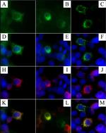 Rabbit IgG (H+L) Cross-Adsorbed Secondary Antibody in Immunocytochemistry (ICC/IF)