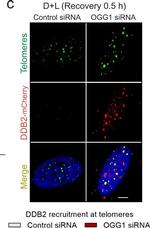 Mouse IgG (H+L) Highly Cross-Adsorbed Secondary Antibody in Immunocytochemistry (ICC/IF)