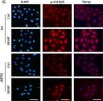 Rabbit IgG (H+L) Cross-Adsorbed Secondary Antibody in Immunocytochemistry (ICC/IF)