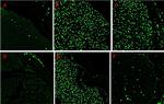 Mouse IgG (H+L) Highly Cross-Adsorbed Secondary Antibody in Immunohistochemistry (Paraffin) (IHC (P))