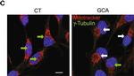 Mouse IgG (H+L) Highly Cross-Adsorbed Secondary Antibody in Immunocytochemistry (ICC/IF)