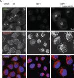 Mouse IgG (H+L) Highly Cross-Adsorbed Secondary Antibody in Immunocytochemistry (ICC/IF)