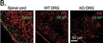 Mouse IgG (H+L) Highly Cross-Adsorbed Secondary Antibody in Immunohistochemistry (Paraffin) (IHC (P))