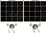 Mouse IgG (H+L) Highly Cross-Adsorbed Secondary Antibody in Immunohistochemistry (IHC)