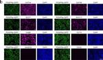 Mouse IgG (H+L) Highly Cross-Adsorbed Secondary Antibody in Immunocytochemistry (ICC/IF)