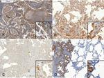 MMP13 Antibody in Immunohistochemistry (Paraffin) (IHC (P))