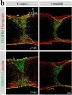 Rat IgG (H+L) Highly Cross-Adsorbed Secondary Antibody in Immunohistochemistry (IHC)