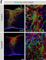 Rat IgG (H+L) Highly Cross-Adsorbed Secondary Antibody in Immunohistochemistry (IHC)