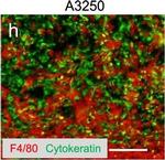 Rabbit IgG (H+L) Cross-Adsorbed Secondary Antibody in Immunohistochemistry (IHC)