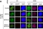 Rabbit IgG (H+L) Cross-Adsorbed Secondary Antibody in Immunocytochemistry (ICC/IF)