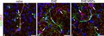 Rabbit IgG (H+L) Cross-Adsorbed Secondary Antibody in Immunohistochemistry (IHC)