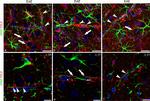 Rabbit IgG (H+L) Cross-Adsorbed Secondary Antibody in Immunohistochemistry (IHC)