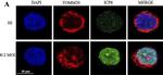 Rabbit IgG (H+L) Cross-Adsorbed Secondary Antibody in Immunocytochemistry (ICC/IF)