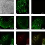 Rabbit IgG (H+L) Highly Cross-Adsorbed Secondary Antibody in Immunohistochemistry (PFA fixed) (IHC (PFA))