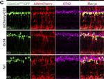 Goat IgG (H+L) Cross-Adsorbed Secondary Antibody in Immunohistochemistry (IHC)