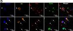 Mouse IgG (H+L) Highly Cross-Adsorbed Secondary Antibody in Immunocytochemistry (ICC/IF)