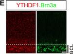 Rabbit IgG (H+L) Highly Cross-Adsorbed Secondary Antibody in Immunohistochemistry (PFA fixed) (IHC (PFA))