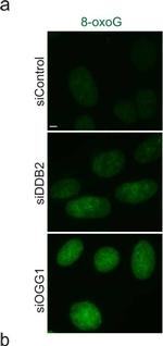 Mouse IgG (H+L) Highly Cross-Adsorbed Secondary Antibody in Immunocytochemistry (ICC/IF)