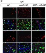 Rabbit IgG (H+L) Highly Cross-Adsorbed Secondary Antibody in Immunocytochemistry (ICC/IF)