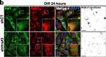 Rabbit IgG (H+L) Highly Cross-Adsorbed Secondary Antibody in Immunocytochemistry (ICC/IF)