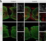 Rat IgG (H+L) Highly Cross-Adsorbed Secondary Antibody in Immunohistochemistry (IHC)