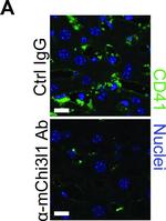 Rat IgG (H+L) Highly Cross-Adsorbed Secondary Antibody in Immunohistochemistry (Paraffin) (IHC (P))