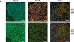 Rabbit IgG (H+L) Highly Cross-Adsorbed Secondary Antibody in Immunohistochemistry (IHC)