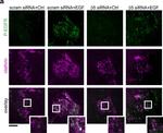 Mouse IgG (H+L) Cross-Adsorbed Secondary Antibody in Immunocytochemistry (ICC/IF)