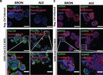 Rabbit IgG (H+L) Highly Cross-Adsorbed Secondary Antibody in Immunohistochemistry (Paraffin) (IHC (P))