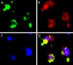 Rabbit IgG (H+L) Cross-Adsorbed Secondary Antibody in Immunohistochemistry (IHC)