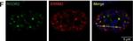 Rabbit IgG (H+L) Secondary Antibody in Immunocytochemistry (ICC/IF)