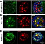 Rabbit IgG (H+L) Secondary Antibody in Immunocytochemistry (ICC/IF)