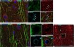 Mouse IgG (H+L) Highly Cross-Adsorbed Secondary Antibody in Immunohistochemistry (IHC)