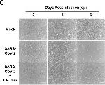 Rabbit IgG (H+L) Highly Cross-Adsorbed Secondary Antibody in Immunocytochemistry (ICC/IF)