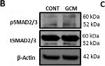 Rabbit IgG (H+L) Secondary Antibody in Western Blot (WB)