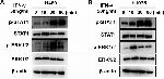 Rabbit IgG (H+L) Secondary Antibody in Western Blot (WB)