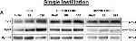 Rabbit IgG (H+L) Secondary Antibody in Western Blot (WB)