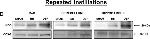 Rabbit IgG (H+L) Secondary Antibody in Western Blot (WB)