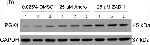 Rabbit IgG (H+L) Secondary Antibody in Western Blot (WB)