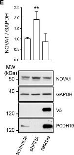 Rabbit IgG (H+L) Secondary Antibody in Western Blot (WB)