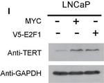 Rabbit IgG (H+L) Secondary Antibody in Western Blot (WB)