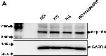 Rabbit IgG (H+L) Secondary Antibody in Western Blot (WB)