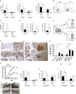 Ly-6G/Ly-6C Antibody in Immunohistochemistry (IHC)