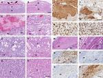 Ly-6G/Ly-6C Antibody in Immunohistochemistry (IHC)