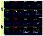 Connexin 26 Antibody in Immunohistochemistry (IHC)