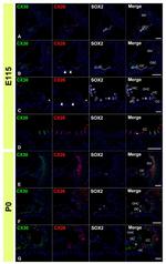 Connexin 26 Antibody in Immunohistochemistry (IHC)